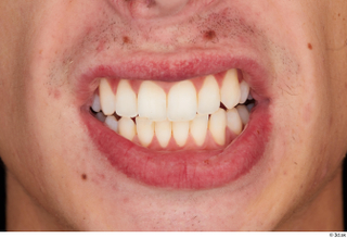 Alessandro Katz teeth 0001.jpg